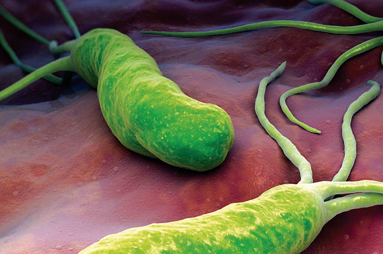 Sintomas bacteria helicobacter