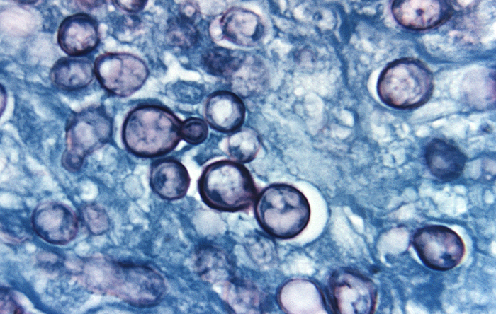 Histoplasma capsulatum