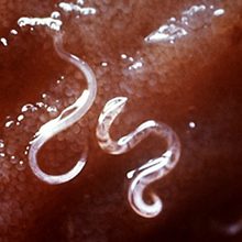 Глисты и паразиты во влагалище: причины появления и лечение
