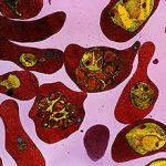 Малярийный плазмодий: жизненный цикл и развитие
