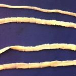 Чем круглые черви отличаются от плоских: сравнение и особенности