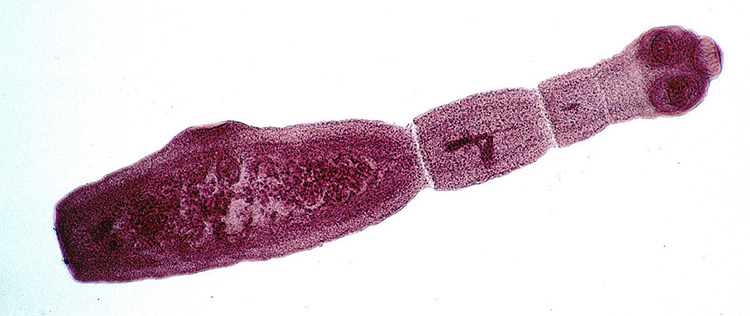 Alveococcus multilocularis
