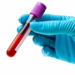 Анализы крови на гельминтов и лямблии: методы и как сдавать